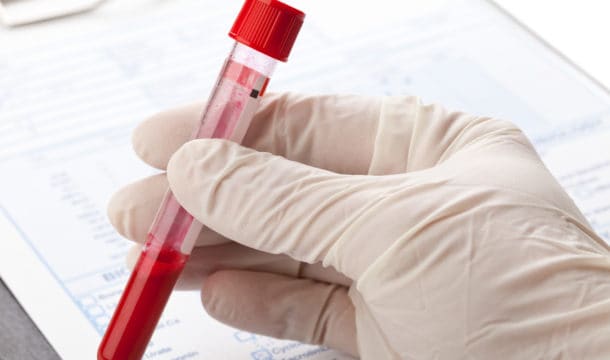 Image of a hand in a latex glove holding a vial of blood.